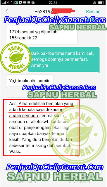 Obat Gondok Beracun yg TERBUKTI MUJARAB Menyembuhkan Gondok Beracun Sampai Sembuh Total