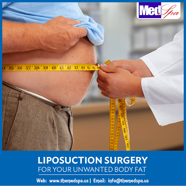 liposuction-weight-loss-surgery