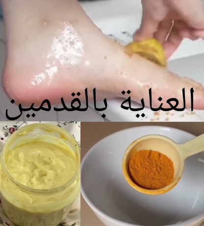 قدم فتاة تضع ليمون على رجلها وماسك الكركم الخاص بالقدمين