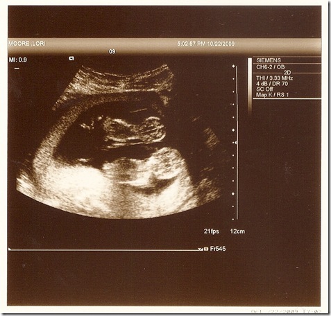 12 weeks, Oct 22, 2009