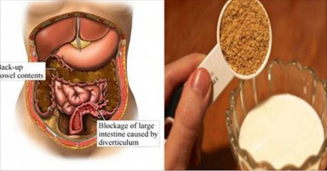 Resultado de imagen para Conoce los 2 Ingredientes más poderosos que limpian tu cuerpo de parásitos y reducen la deposición de grasa!