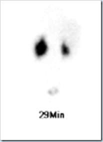 renal scan 1