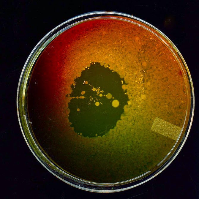 Bacterial Self Portrait by Olivia Vankuiken