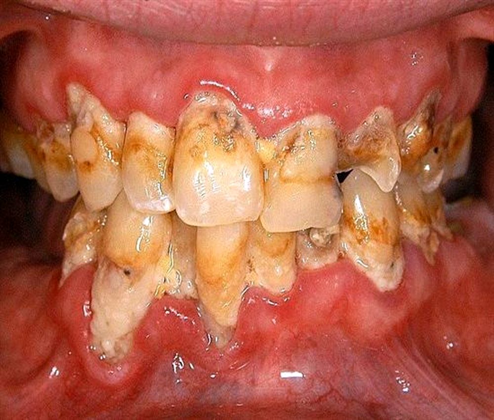 Drugs Oral Health