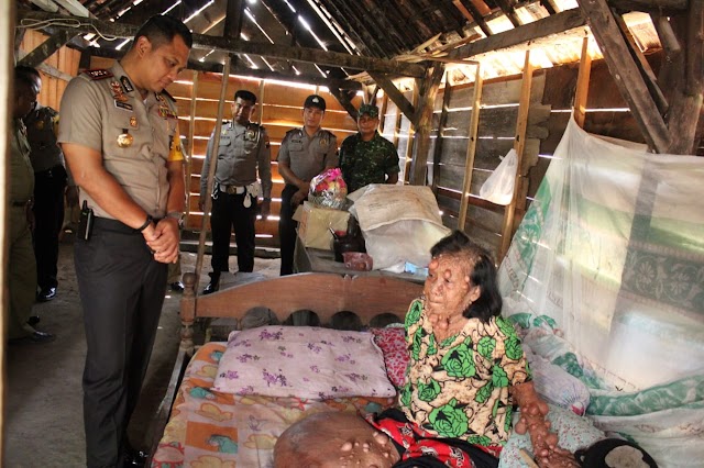 Kapolres Blora Kunjungi Lasiyem, Penderita Tumor Menahun