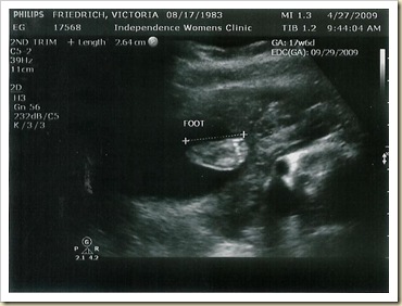 ultrasound_5