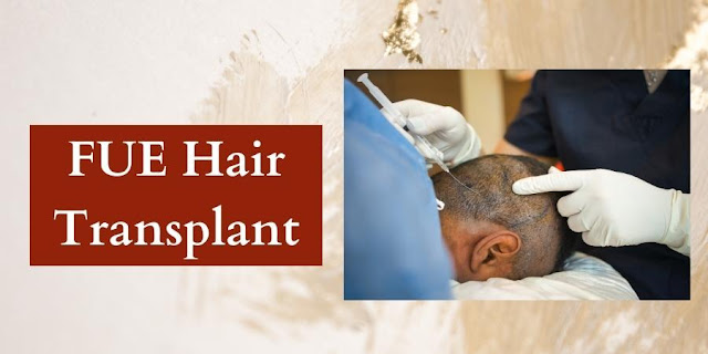 FUE Hair Transplant