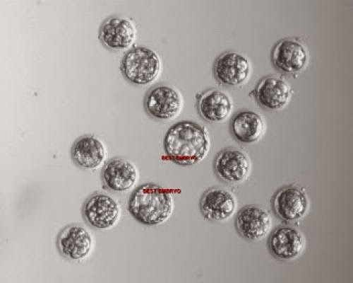 Grading Ivf Embryos