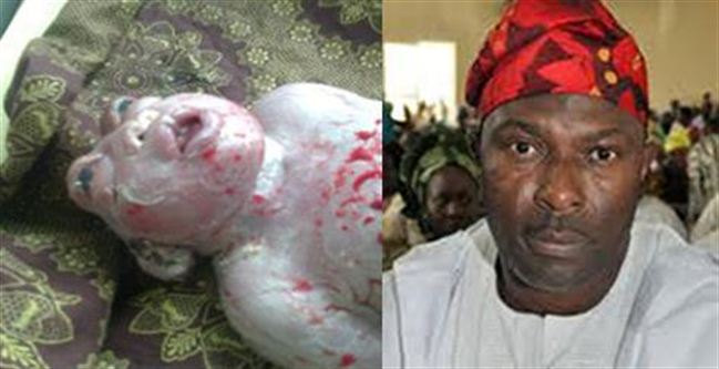 Gempar Bayi Berkepala Katak Dilahirkan di Nigeria 
