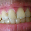How To Maintain Healthy Teeth