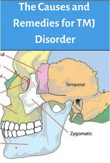 The Causes and Remedies for TMJ Disorder