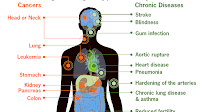 Health effects of tobacco