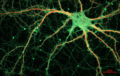 Close-up neuron berwarna hijau dan oranye dengan akson merah pada latar belakang hitam