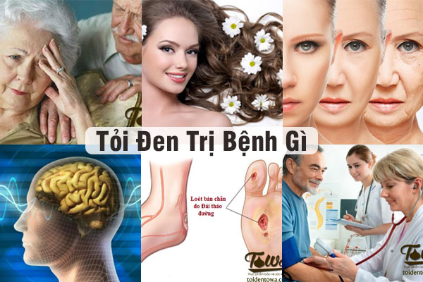 Tỏi Đen Trị Bệnh Gì