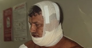 Comerciante é baleado por homens encapuzados em Serrinha