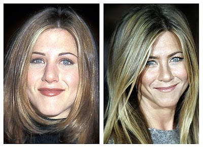 Jennifer Aniston Plastic Surgery Before And After