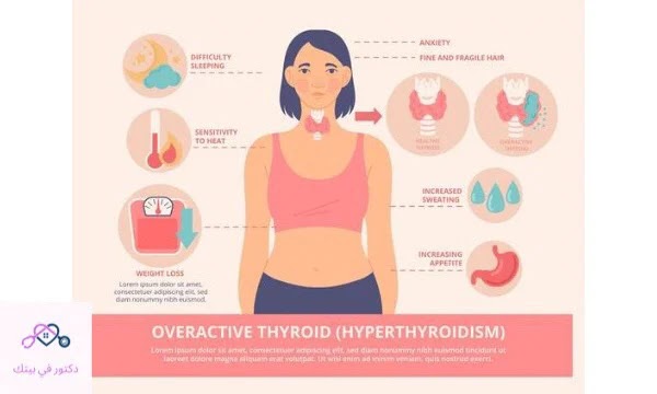 نشاط الغدة الدرقية hyperthyroidism ما هي الاعراض وكيفية العلاج_دكتور في بيتك