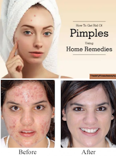 Milk-honey-rice-flour-face-mask-pimples-acne