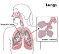 About Lung Disease