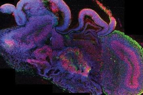 Crean el primer cerebro humano de laboratorio