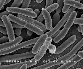 Gambar monera Escherichia coli