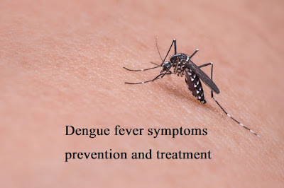 Dengue fever symptoms prevention and treatment