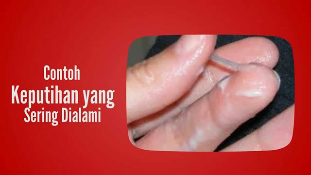 Obat Keputihan Herbal Cina