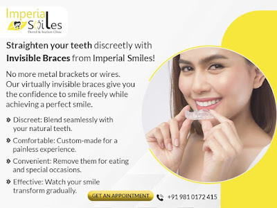 Invisible Braces Treatment in Gurgaon