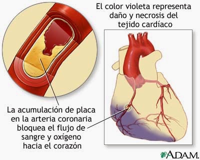 Cuestión de salud