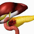 5 Nursing Diagnosis for Pancreatitis