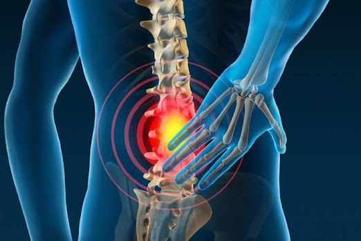 what are the five most common causes of low back injury?