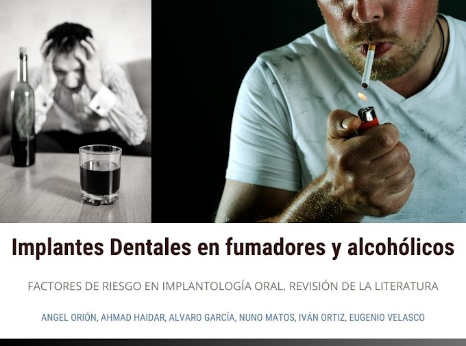 PDF: Implantes Dentales en pacientes fumadores y alcohólicos