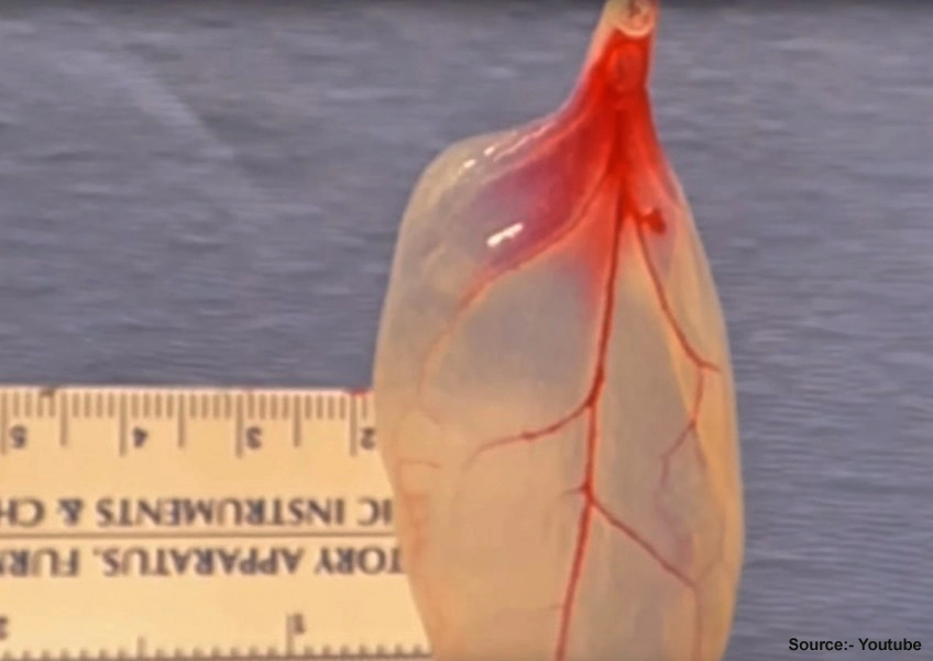 How Scientists Turned A Spinach Leaf Into Beating Heart Tissue