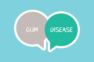 Gum Disease Oral Surgeon Deep Cleaning Necessary