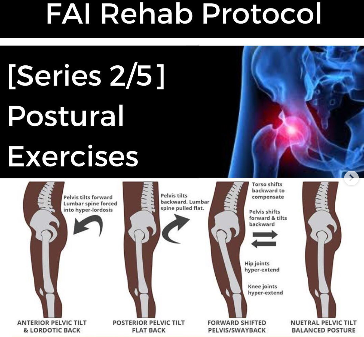 FAI Rehab Protocol Part 2 - Postural Exercises - themanualtherapist.com