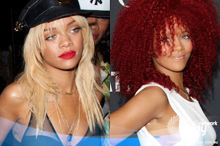 rihanna plastic surgery, plastic surgery, plastic surgery photos, cosmetic plastic surgery