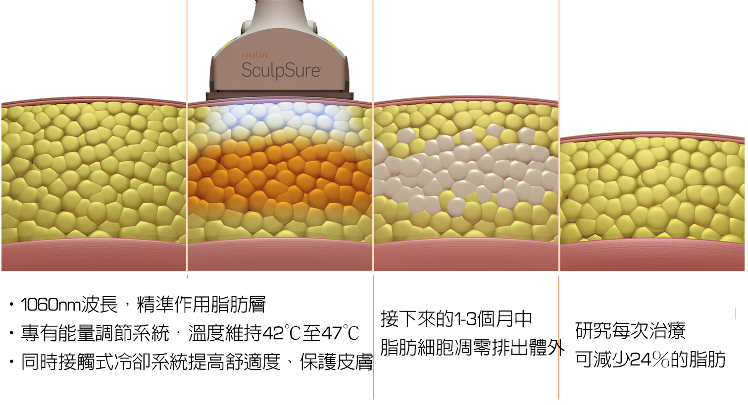  SculpSure體雕減肥好難燒肉非侵入式體雕吃減肥藥不好絲酷秀雷射體雕熱量有多少二極體冷凍溶脂雞排起司雞排鹹酥雞體脂肪費用做幾次術後修復價格恢復期減肥日記減肥食譜術後冷凍減脂雷射溶脂局部平坦小腹腰內肉林上立上立皮膚科診所塑身運動曲線雕塑愛吃大餐上立皮膚科