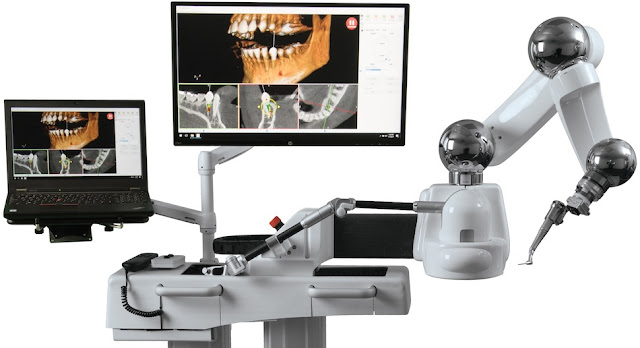Il sistema robotico dentale Yomi. [Foto: ArchPoint]