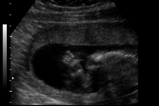 BABY_14