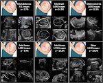 What are the 5 uses of ultrasound