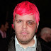 Perez Hilton gets a BLACK EYE from the Black Eyed Peas?