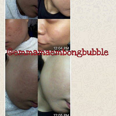 Emma Maembong Bubble Soap