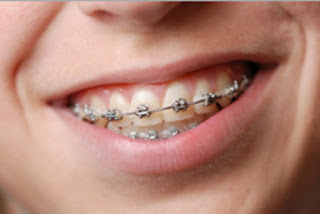 Dental Care Tips for Children From Different Age Brackets.