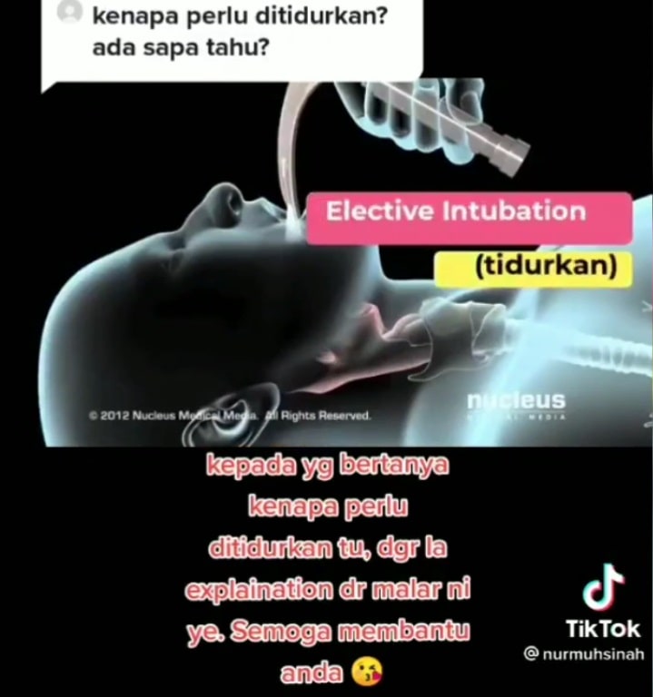 kenapa pesakit covid ditidurkan? sembuh atau meninggal dunia?