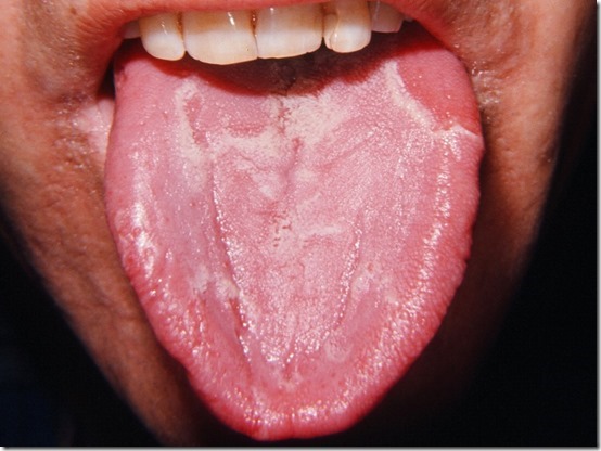  lengua geográfica FOTOS BUSCOIMAGENES COM (5)