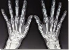x-ray