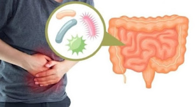 10 Warning #Signs You Have an #Unhealthy #Gut and How to #Build a #Healthy #One #Again #Health #remedies