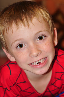 Toothless