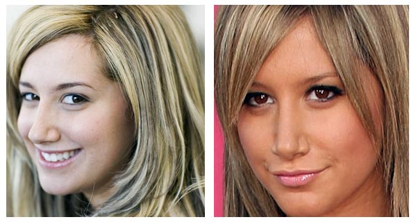 Ashley Tisdale Nose Job Before