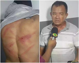 Vereador é atacado, leva surra e diz que foi a mando de adversários